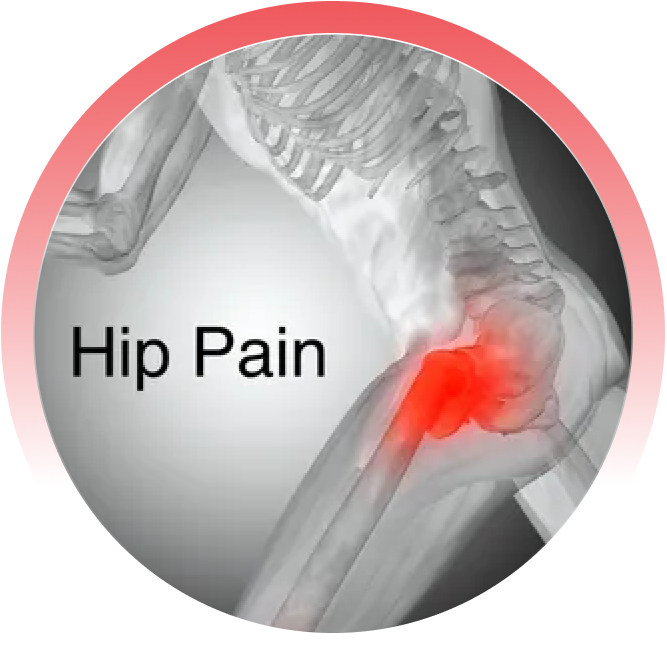 Hip-pain skeleton image